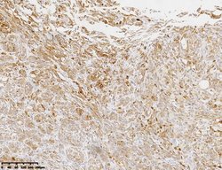 MLANA Monoclonal Antibody (OTI1A2), TrueMAB , OriGene 30 &mu;L | Buy Online | Origene Technologies | Fisher Scientific