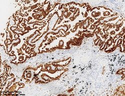 NAPSA Monoclonal Antibody (OTI8A5), TrueMAB , OriGene 100 &mu;L; Unconjugated:Antibodies,