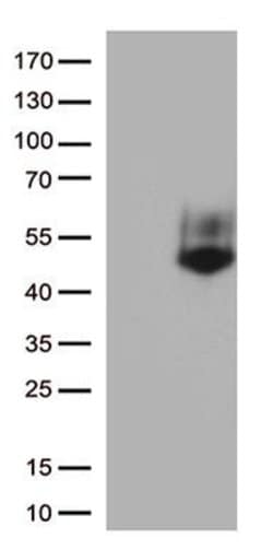 FCGR3A Monoclonal Antibody (OTI2A2), TrueMAB , OriGene 30 &mu;L | Buy Online | Origene Technologies | Fisher Scientific