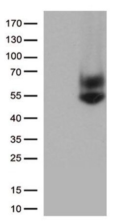 FCGR3A Monoclonal Antibody (OTI12D8), TrueMAB , OriGene 100 &mu;L; Unconjugated:Antibodies,