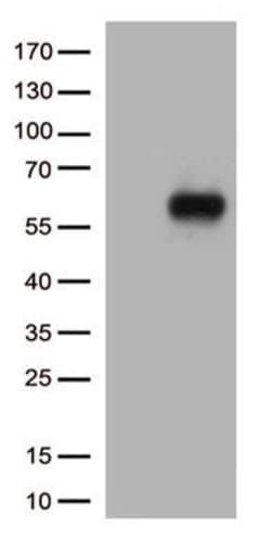 IL3RA Monoclonal Antibody (OTI1E12), TrueMAB , OriGene:Antibodies:Primary