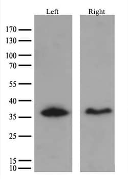 HSD17B13 Monoclonal Antibody (OTI5C4), TrueMAB , OriGene 30 &mu;L | Buy Online | Origene Technologies | Fisher Scientific