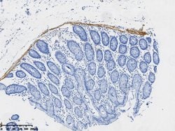 Desmin Monoclonal Antibody (OTI14E7), TrueMAB , OriGene 30 &mu;L; Unconjugated:Anticuerpos