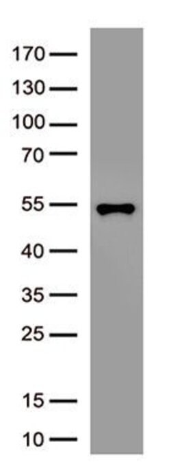 SARS-CoV-2 N Protein Monoclonal Antibody (OTI10B2), TrueMAB , OriGene 100 &mu;L | Buy Online | Origene Technologies | Fisher Scientific