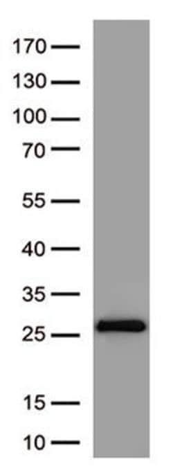 SARS-CoV-2 Spike Protein Monoclonal Antibody (OTI4C6), TrueMAB , OriGene