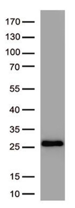SARS-CoV-2 Spike Protein Monoclonal Antibody (OTI3A2), TrueMAB , OriGene