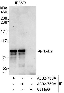 TAB2 Rabbit anti-Human, Polyclonal, Bethyl Laboratories 100 &mu;L; Unconjugated:Antibodies,