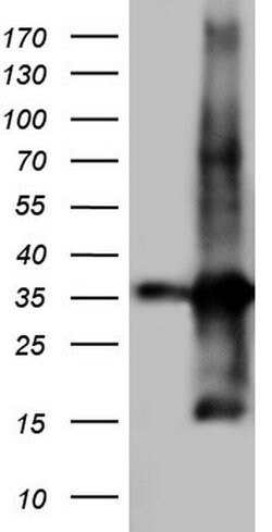 TACC2 Monoclonal Antibody (OTI4D10), TrueMAB , OriGene 100 &mu;L; Unconjugated:Antibodies,