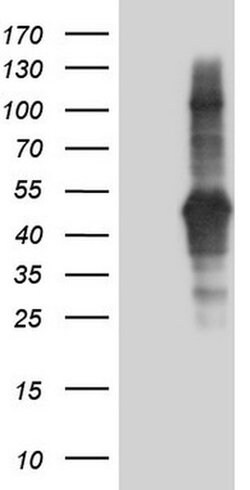 TACC2 Monoclonal Antibody (OTI7F12), TrueMAB , OriGene 100 &mu;L; Unconjugated:Antibodies,