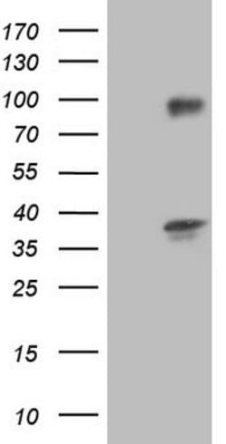 TACC2 Mouse anti-Human, Clone: OTI4A6, lyophilized, TrueMAB 100 &mu;g;
