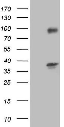 TACC2 Monoclonal Antibody (OTI4A6), TrueMAB , OriGene:Antibodies:Primary