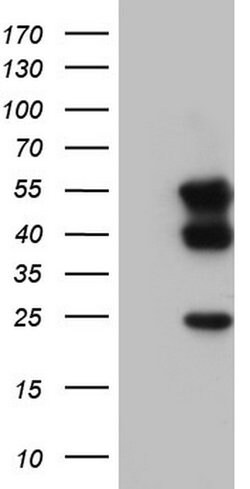 TACC2 Mouse anti-Human, Clone: OTI5H1, lyophilized, TrueMAB 100 &mu;g;