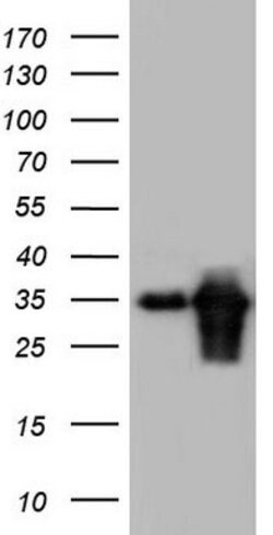 TACC2 Mouse anti-Human, Clone: OTI8A5, lyophilized, TrueMAB 100 &mu;g;