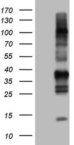TACC2 Monoclonal Antibody (OTI8D11), TrueMAB , OriGene 100 &mu;L | Buy Online | Origene Technologies | Fisher Scientific