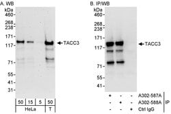 TACC3 Rabbit anti-Human, Polyclonal, Bethyl Laboratories 100 &mu;L; Unconjugated:Antibodies,
