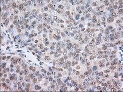 TACC3 Monoclonal Antibody (OTI8F6), TrueMAB , OriGene 100 &mu;L; Unconjugated:Antibodies,