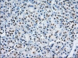 TACC3 Monoclonal Antibody (OTI8F6), TrueMAB , OriGene 100 &mu;L; Unconjugated:Antibodies,