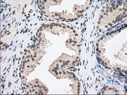 TACC3 Monoclonal Antibody (OTI8F6), TrueMAB , OriGene:Antibodies:Primary