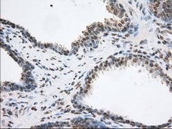 TACC3 Monoclonal Antibody (OTI8F6), TrueMAB , OriGene:Antibodies:Primary