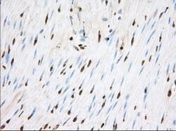 TACC3 Monoclonal Antibody (OTI8F6), TrueMAB , OriGene 100 &mu;L; Unconjugated:Antibodies,