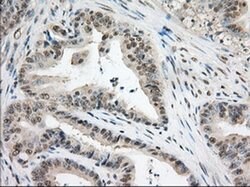 TACC3 Monoclonal Antibody (OTI8F6), TrueMAB , OriGene 100 &mu;L; Unconjugated:Antibodies,