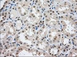 TACC3 Monoclonal Antibody (OTI8F6), TrueMAB , OriGene 100 &mu;L; Unconjugated:Antibodies,