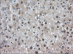 TACC3 Monoclonal Antibody (OTI8F6), TrueMAB , OriGene 100 &mu;L; Unconjugated:Antibodies,