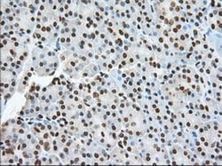 TACC3 Monoclonal Antibody (OTI6F1), TrueMAB , OriGene 100 &mu;L; Unconjugated:Antibodies,