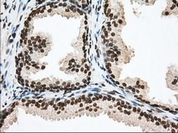 TACC3 Monoclonal Antibody (OTI6F1), TrueMAB , OriGene 100 &mu;L; Unconjugated:Antibodies,