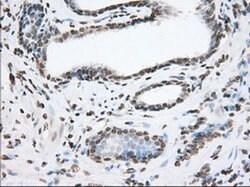 TACC3 Monoclonal Antibody (OTI6F1), TrueMAB , OriGene 100 &mu;L; Unconjugated:Antibodies,