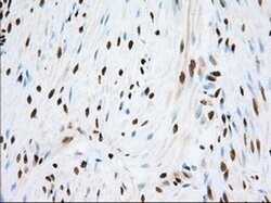 TACC3 Monoclonal Antibody (OTI6F1), TrueMAB , OriGene 100 &mu;L; Unconjugated:Antibodies,