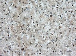 TACC3 Monoclonal Antibody (OTI6F1), TrueMAB , OriGene 100 &mu;L; Unconjugated:Antibodies,