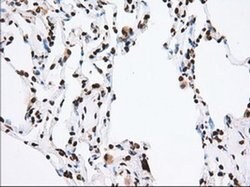 TACC3 Monoclonal Antibody (OTI6F1), TrueMAB , OriGene 100 &mu;L; Unconjugated:Antibodies,