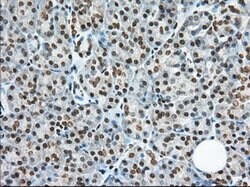 TACC3 Mouse anti-Human, Clone: OTI1E8, lyophilized, TrueMAB 100 &mu;g;