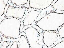 TACC3 Mouse anti-Human, Clone: OTI1E8, lyophilized, TrueMAB 100 &mu;g;
