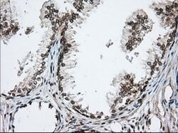 TACC3 Mouse anti-Human, Clone: OTI1E8, lyophilized, TrueMAB 100 &mu;g;