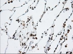 TACC3 Mouse anti-Human, Clone: OTI1E8, lyophilized, TrueMAB 100 &mu;g;