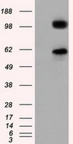 TACC3 Monoclonal Antibody (OTI8F6), TrueMAB , OriGene 100 &mu;L; Unconjugated:Antibodies,