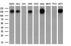 TACC3 Monoclonal Antibody (OTI8F6), TrueMAB , OriGene 100 &mu;L; Unconjugated:Antibodies,