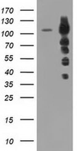 TACC3 Monoclonal Antibody (OTI8B7), TrueMAB , OriGene 100 &mu;L; Unconjugated:Antibodies,