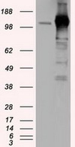 TACC3 Monoclonal Antibody (OTI6F1), TrueMAB , OriGene 100 &mu;L; Unconjugated:Antibodies,