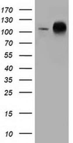 TACC3 Monoclonal Antibody (OTI1E11), TrueMAB , OriGene 30 &mu;L | Buy Online | OriGene | Fisher Scientific