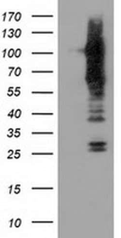 TACC3 Monoclonal Antibody (OTI6H4), TrueMAB , OriGene 100 &mu;L; Unconjugated:Antibodies,