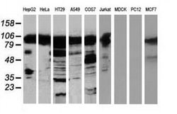 TACC3 Monoclonal Antibody (OTI6H4), TrueMAB , OriGene 100 &mu;L; Unconjugated:Antibodies,