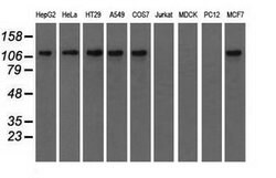 TACC3 Mouse anti-Human, Clone: OTI1E8, lyophilized, TrueMAB 100 &mu;g;