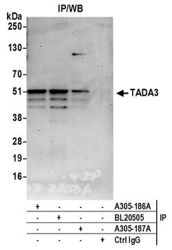 TADA3/TADA3L Rabbit anti-Human, Polyclonal, Bethyl Laboratories 10 &mu;L;