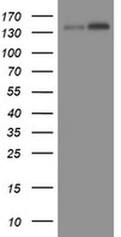 TAF2 Monoclonal Antibody (OTI2A5), TrueMAB , OriGene 100 &mu;L; Unconjugated:Antibodies,