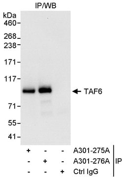 TAF6 Rabbit anti-Human, Polyclonal, Bethyl Laboratories 100 &mu;L; Unconjugated:Antibodies,
