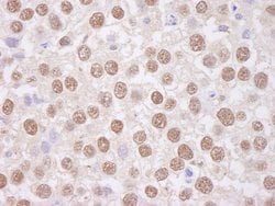 TAFII68 Rabbit anti-Human, Polyclonal, Bethyl Laboratories 100 &mu;L; Unconjugated:Antibodies,