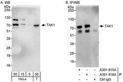 TAK1 Rabbit anti-Human, Polyclonal, Bethyl Laboratories 100 &mu;l; Unlabeled:Antibodies,